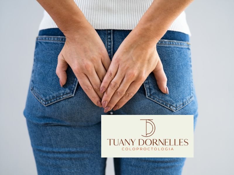 Abscesso Anal e Fistula Anal