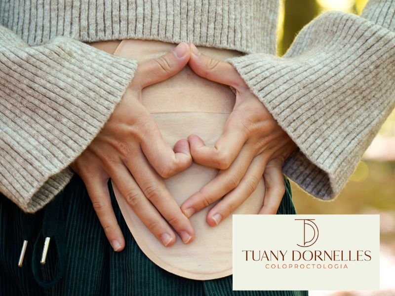 Ileostomia ou Colostomia