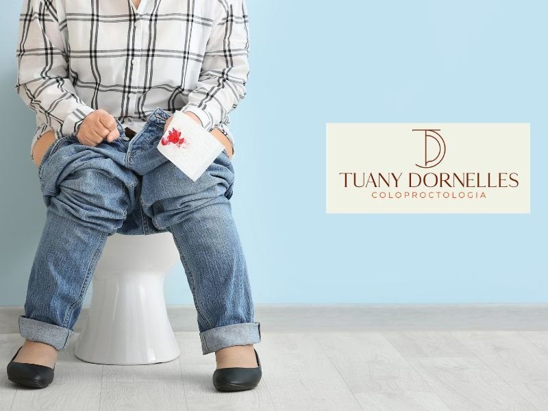 Procedimento para Prolapso Retal