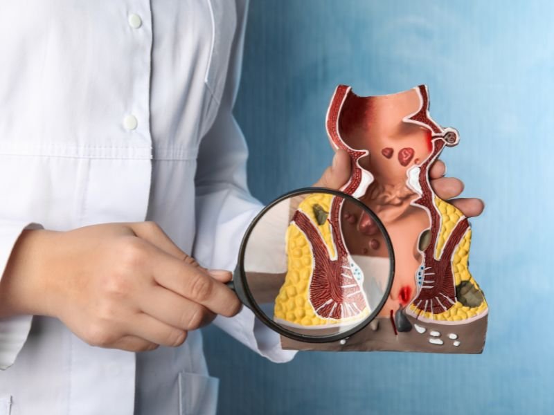 Solucao definitiva para hemorroidas Porto Alegre